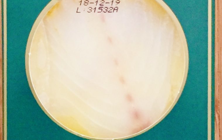 Envase de carpaccio de bacalao marca La Balinesa de 150 gramos. Se puede ver el producto a través de una ventana circular.